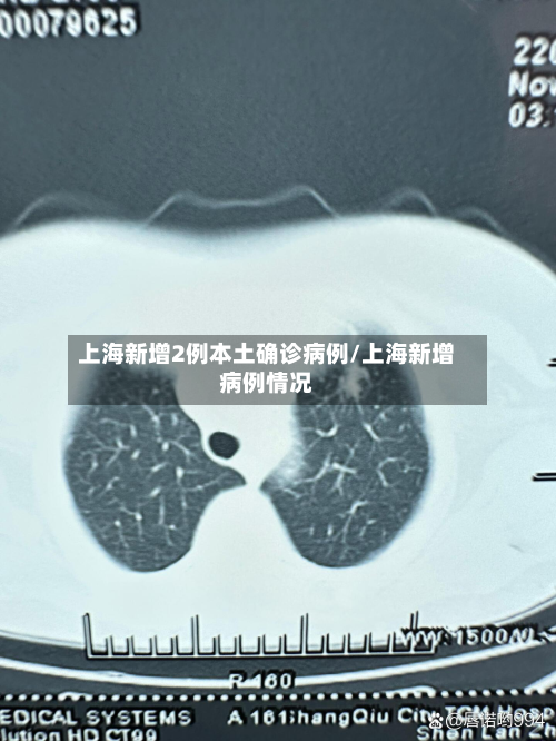 上海新增2例本土确诊病例/上海新增病例情况-第2张图片