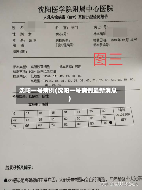 沈阳一号病例(沈阳一号病例最新消息)