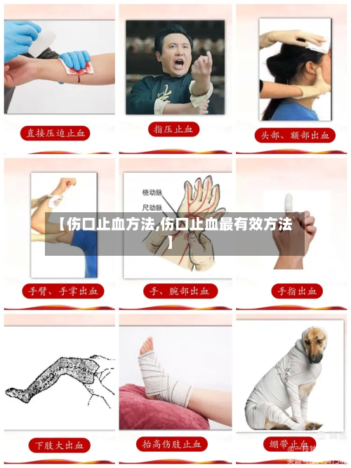 【伤口止血方法,伤口止血最有效方法】