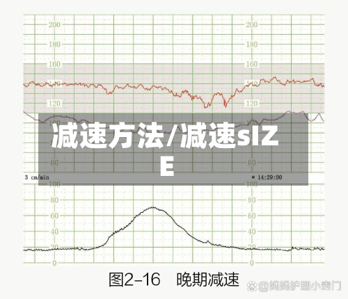 减速方法/减速sIZE-第2张图片