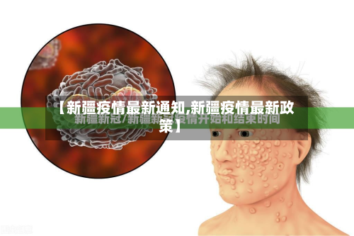 【新疆疫情最新通知,新疆疫情最新政策】-第2张图片