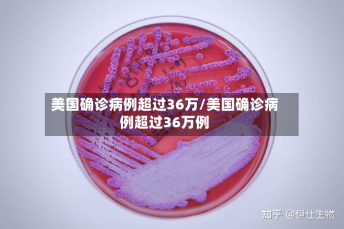 美国确诊病例超过36万/美国确诊病例超过36万例